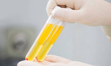 تجارة الدم .. عراقيون يبيعون البلازما لمواجهة الجوع والفقر