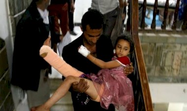 في 7 سنوات.. كيف حوَّل الحوثيون اليمن من مركز العرب إلى أفقر دول المنطقة؟