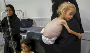 فشل روايات نتنياهو بشأن تكذيب مجاعات غزة.. العالم يكشف الوجه الآخر لإسرائيل