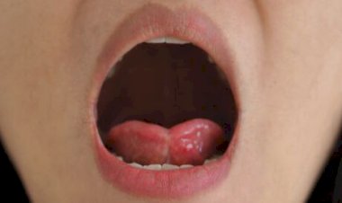 خطورة بلع اللسان وأهمية الإسعاف السريع في إنقاذ الأرواح