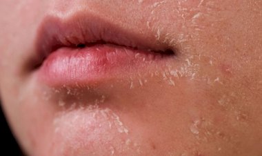 وصفات منزلية لتقشير وترطيب البشرة الجافة خلال الخريف والشتاء