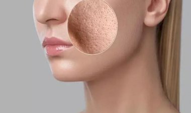8 وصفات طبيعية لعلاج المسام الواسعة وتحسين ملمس البشرة
