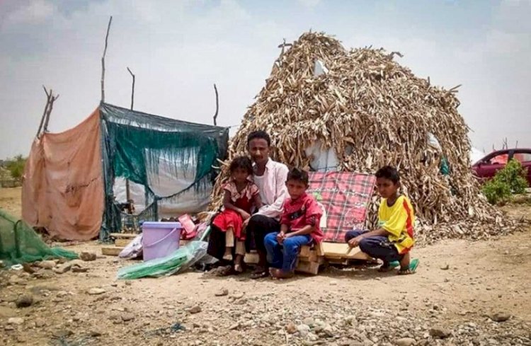معاناة النازحين في اليمن .. الأوبئة تكدر حياتهم