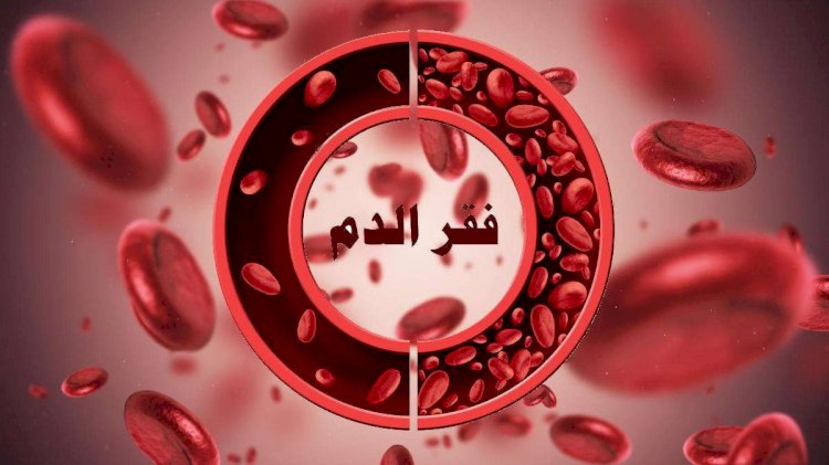 الأنيميا.. مرض صامت يهدد الصحة.. إليك طرق التعامل معه