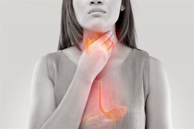 الحموضة والحرقان.. الأسباب و الأعراض و طرق العلاج