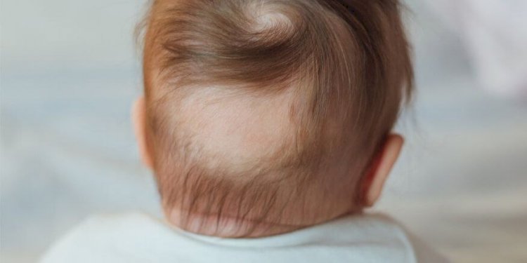 تساقط الشعر عند الأطفال.. الأسباب والعلاج وطرق الوقاية
