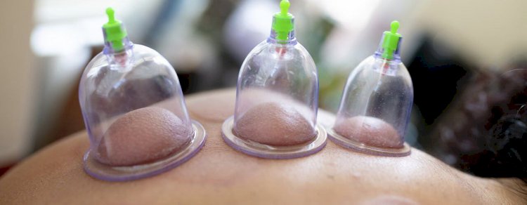 أعراض ما بعد الحجامة وكيفية التعامل معها