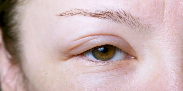 طرق فعّالة للتخلّص من انتفاخ العين بعد البكاء.. دليل منزلي بسيط