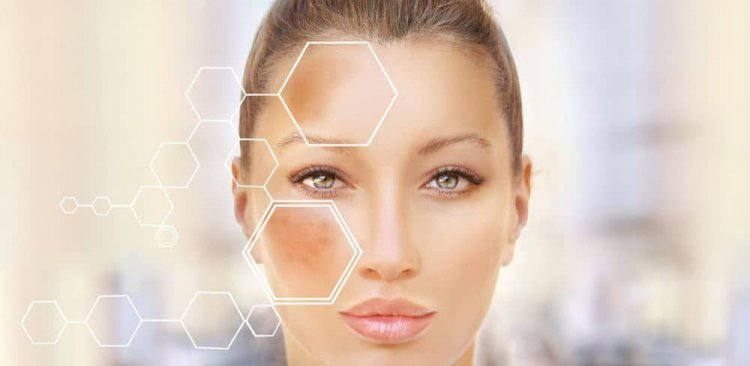 ببشرة صافية وإشراقة طبيعية.. 3 طرق منزلية لتوحيد اللون والتخلص من البقع الداكنة